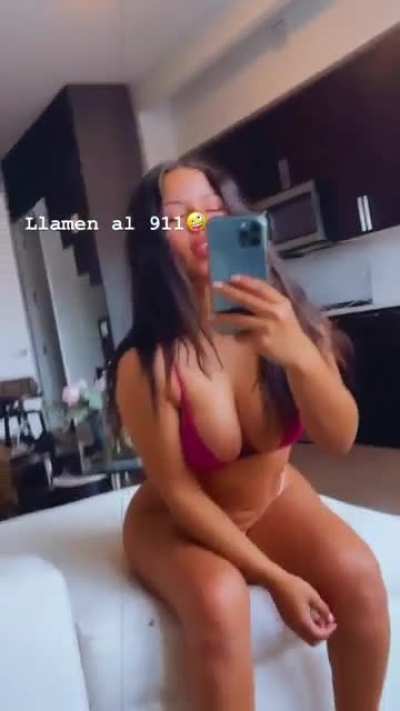 911
