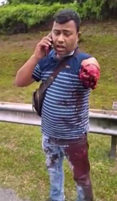 Man calls ambulance with remaining arm