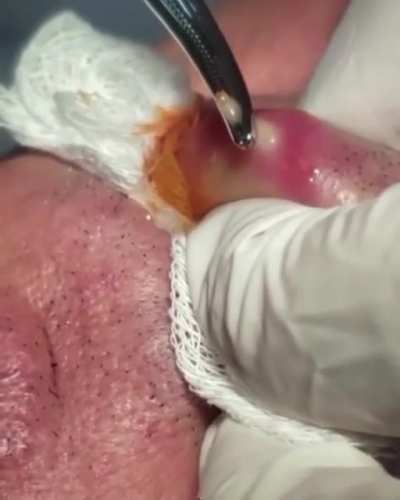 Lip Larvae