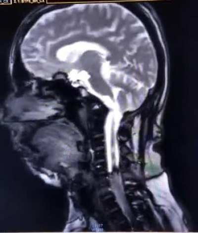When you are in MRI but the beat drops...
