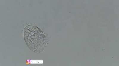 The death of a single celled organism. RIP