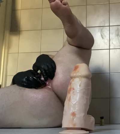 Poopy prolapse