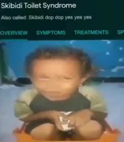 XD
