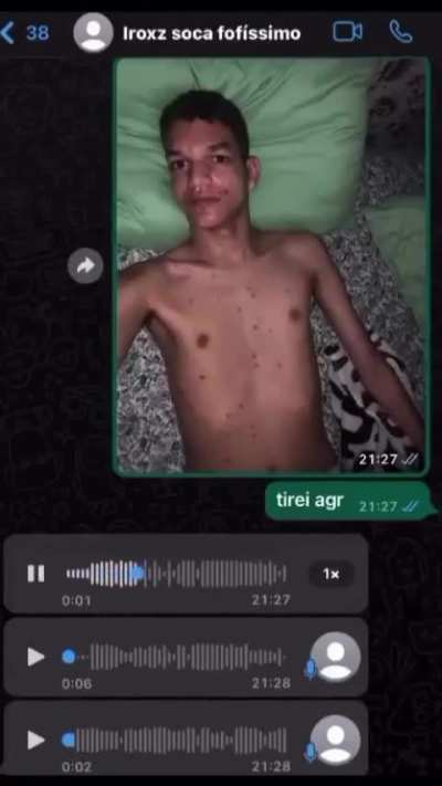 Oli Natu com catapora