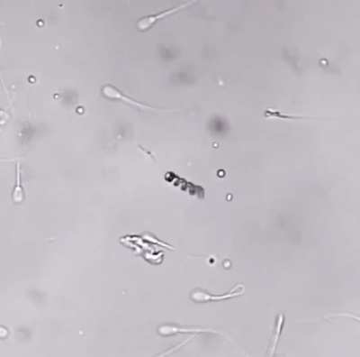 A nanorobot takes the sperm and carries it to the egg cell, performing the fertilization process.