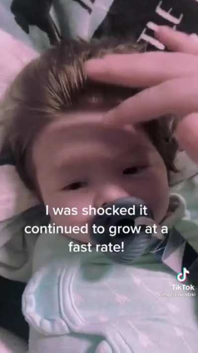Baby born with full head of hair