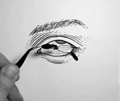 Itchy eyes