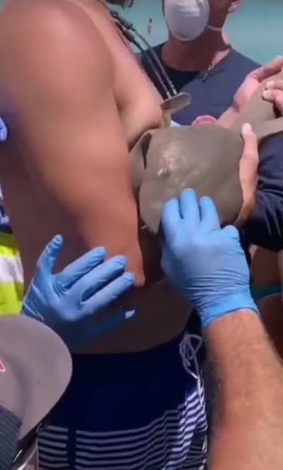 Man's more worried about paying his medical bill than the Shark bite