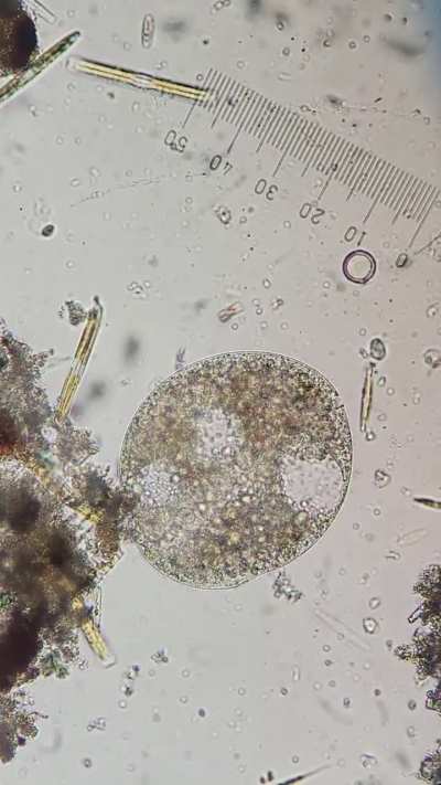 Is this genus Frontonia? Very new and doing my best lol