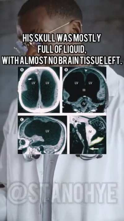 brain.exe not found, try again later.