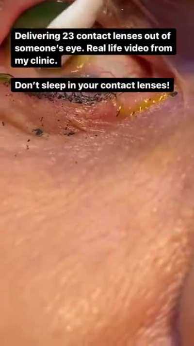 Dont forget to remove them