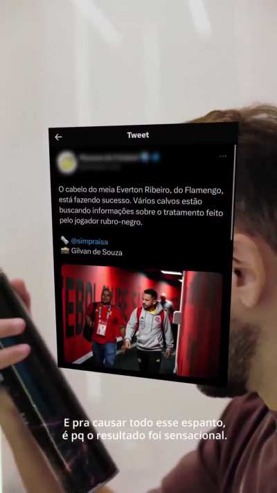 Everton Ribeiro revela como se tornou um ex calvo