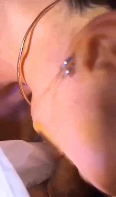 Intensity