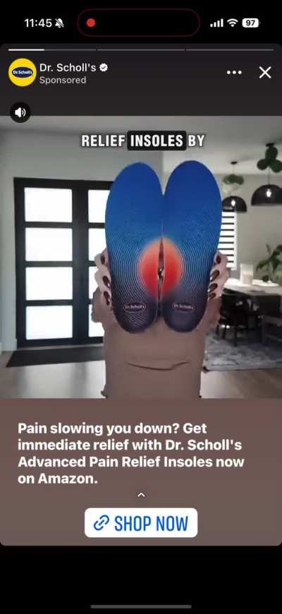 “Really high arches” 😍