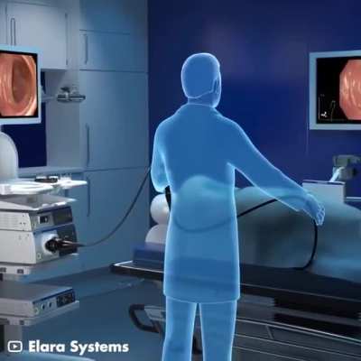 This is how a colonoscopy is performed.