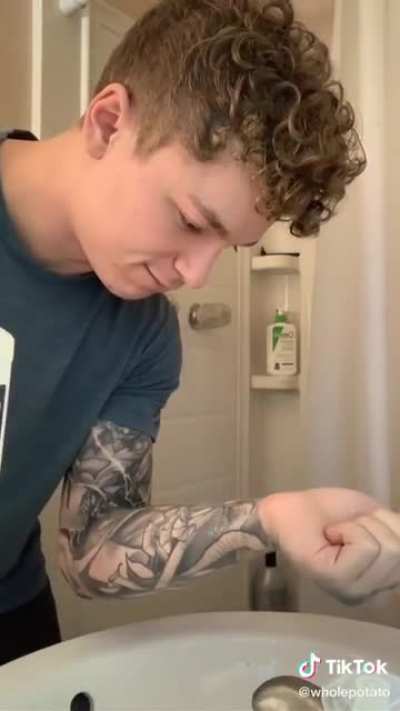 I accidentally burndeded myself
