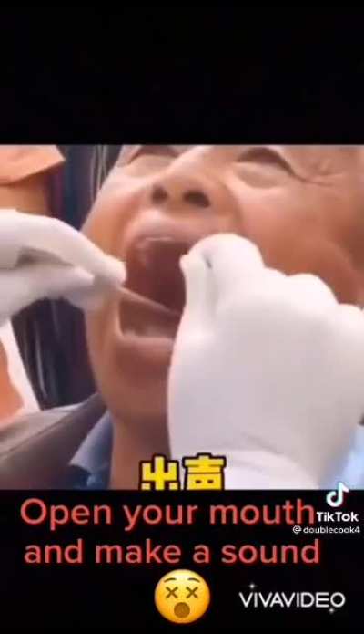 Definitely belongs here