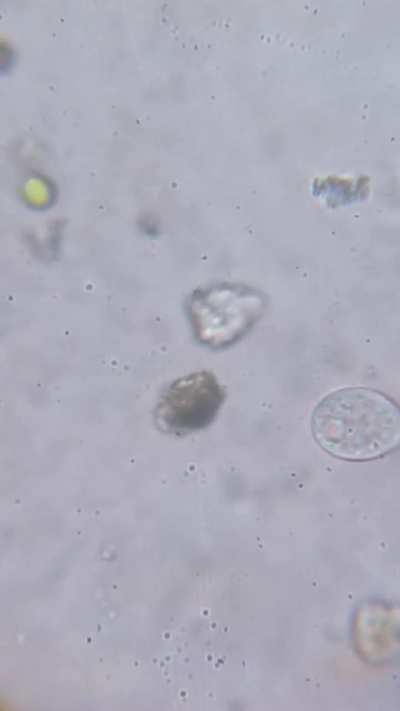 I'd be really be glad if i get the ID of these ciliates.