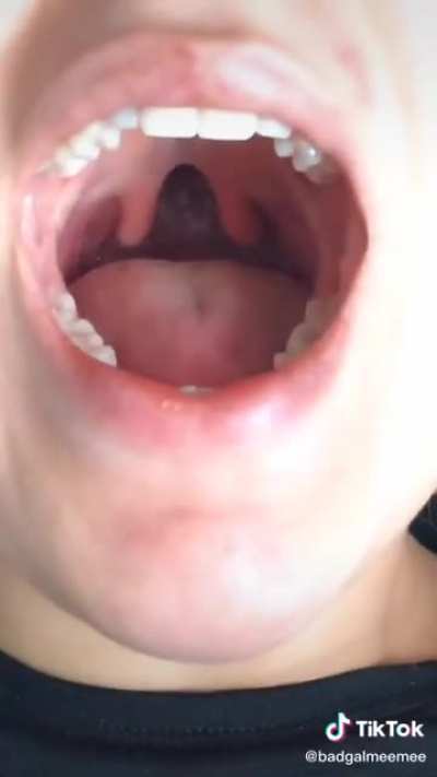 Doctors/residents/med students of reddit pls explain