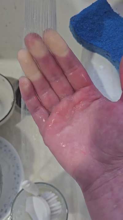 I have Raynaud's. This is the very unrecommended way to warm my fingers up but I suffer for science