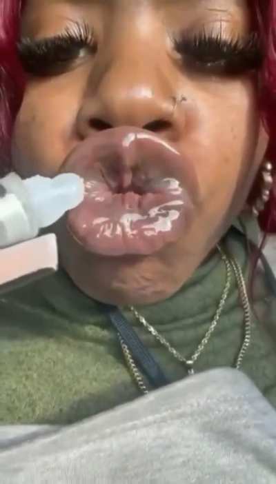 Look at it dripp<wbr>in😵‍💫<wbr>🥜🥜