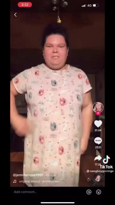 Couldn't find original vid but holy fuck, why would you post this unironically.