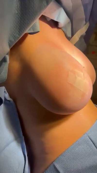 Logan's New Tits