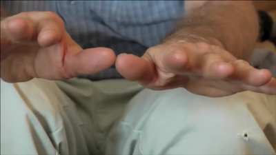 Weed+ Parkinson’s incredible