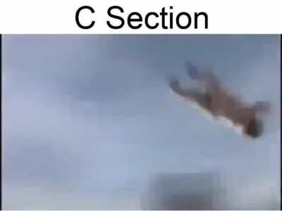 C Section is kind of cool