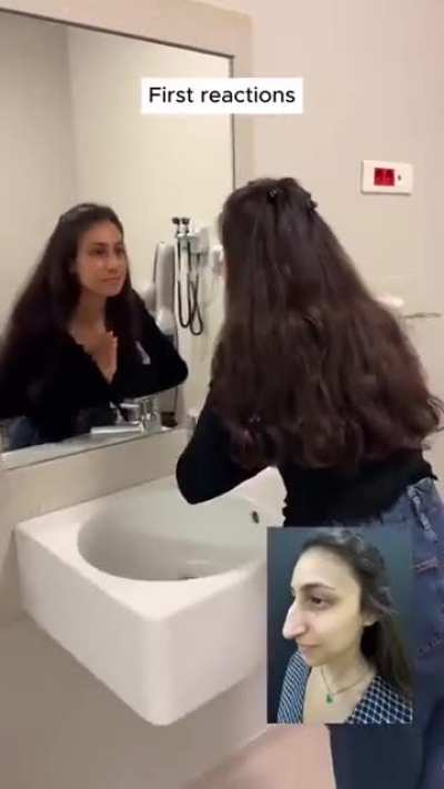 3 Sister's Rhinoplasty Adventure