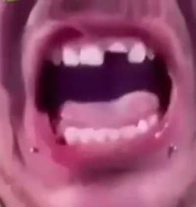 😐