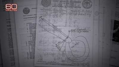 Jeffrey Epstein autopsy explained