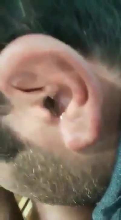 What’s in your ear?