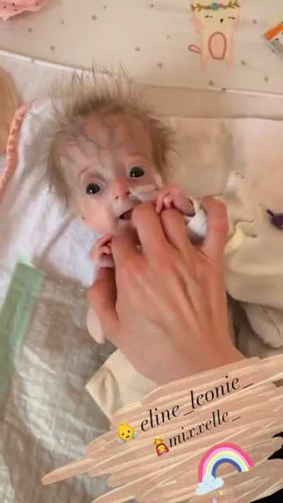 olum bebek çok erken doğmuş