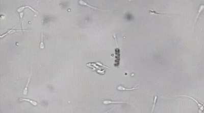 A nanobot picks up a lazy sperm by the tail and inseminates an egg with it