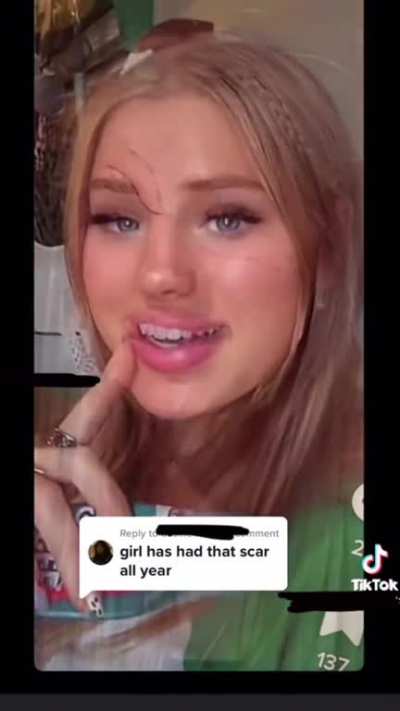 New trend… fake scars drawn on the face