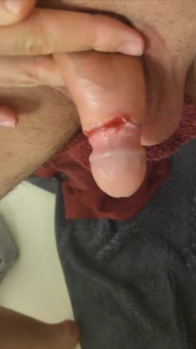Update from previous post