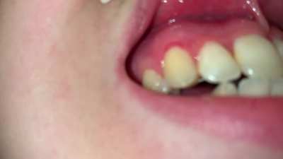 Teeth