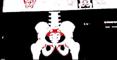 Boner