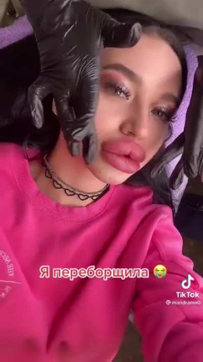 Look at those lips