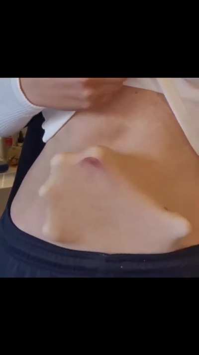 Thats what we call a stomachache