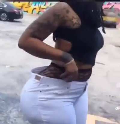 Found on another sub so sorry if a repost. What kind of drugs was her surgeon on? This poor woman.